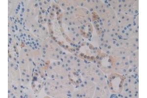 Detection of FcaR in Rat Kidney Tissue using Polyclonal Antibody to Fc Fragment Of IgA Receptor (FcaR) (FCAR Antikörper  (AA 51-280))