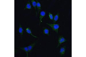 IF analysis of HGS using anti-HGS antibody (ABIN7601205). (HGS Antikörper  (AA 3-777))
