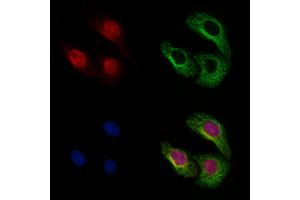 ABIN6262106 and ABIN6273119 staining Hela by IF/ICC. (GSDMD Antikörper)