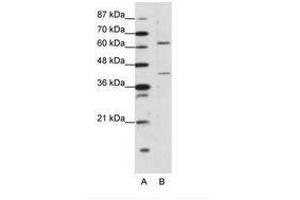 Image no. 1 for anti-Forkhead Box P4 (FOXP4) (C-Term) antibody (ABIN203239) (FOXP4 Antikörper  (C-Term))