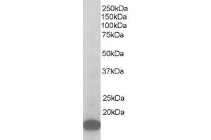 Western Blotting (WB) image for anti-Actin Related Protein 2/3 Complex, Subunit 3, 21kDa (ARPC3) (C-Term) antibody (ABIN185223)
