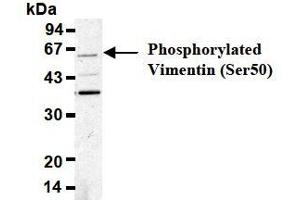 Western Blotting (WB) image for anti-Vimentin (VIM) (pSer50) antibody (ABIN1449160) (Vimentin Antikörper  (pSer50))