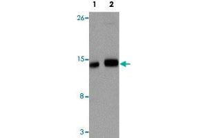 Western blot analysis of IFITM1 in NIH/3T3 cell lysate with IFITM1 polyclonal antibody  at (1) 1 and (2) 2 ug/mL. (IFITM1 Antikörper  (Internal Region))