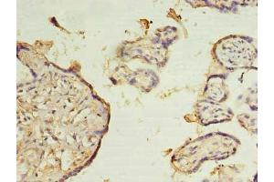 Immunohistochemistry of paraffin-embedded human placenta tissue using ABIN7176101 at dilution of 1:100 (ZMYND19 Antikörper  (AA 1-227))