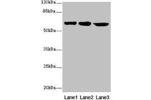 Western blot All lanes: CATSPER2 antibody at 4 μg/mL Lane 1: Jurkat whole cell lysate Lane 2: HepG2 whole cell lysate Lane 3: 293T whole cell lysate Secondary Goat polyclonal to rabbit IgG at 1/10000 dilution Predicted band size: 63, 62, 49, 24 kDa Observed band size: 63 kDa (CATSPER2 Antikörper  (AA 5-112))