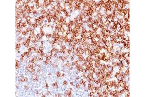IHC testing of human tonsil stained with CD45RO antibody (UCHL-1). (CD45RO Antikörper)