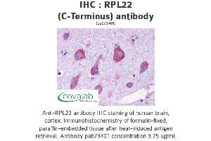 Image no. 1 for anti-Ribosomal Protein L22 (RPL22) (C-Term) antibody (ABIN1738940)