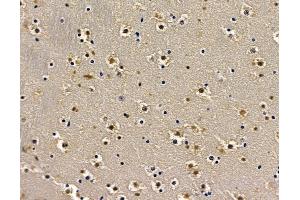 BRAT1 Antibody at 1/100 staining mouse brain tissue by IHC-P.