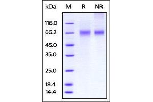 Biotinylated Human EGFRvIII, His Tag on SDS-PAGE under reducing (R) and no-reducing (NR) conditions.