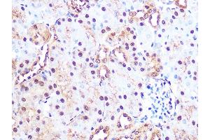 Immunohistochemistry of paraffin-embedded mouse kidney using PSM Rabbit mAb (ABIN7269600) at dilution of 1:100 (40x lens).