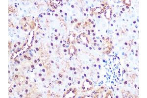 Immunohistochemistry of paraffin-embedded mouse kidney using PSM Rabbit mAb (ABIN7269600) at dilution of 1:100 (40x lens). (PSMA3 Antikörper)