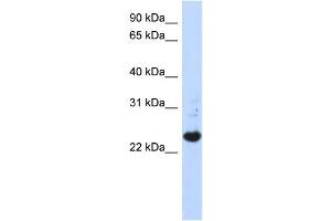 WB Suggested Anti-C21orf56 Antibody Titration:  0. (C21ORF56 Antikörper  (N-Term))