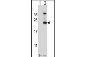 Western blot analysis of TSN6 (arrow) using rabbit polyclonal TSN6 Antibody (C-term) (ABIN6242668 and ABIN6579053).