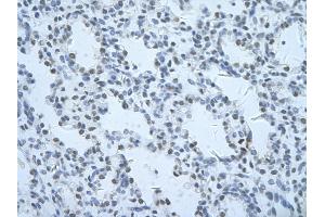 Rabbit Anti-THOC1 Antibody       Paraffin Embedded Tissue:  Human alveolar cell   Cellular Data:  Epithelial cells of renal tubule  Antibody Concentration:   4.
