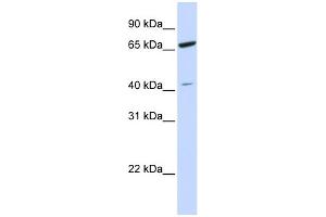 WB Suggested Anti-ZNF334 Antibody Titration: 0. (ZNF334 Antikörper  (N-Term))