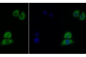 Detection of IL11Ra in Human Hela cell using Polyclonal Antibody to Interleukin 11 Receptor Alpha (IL11Ra) (IL11RA Antikörper  (AA 59-217))