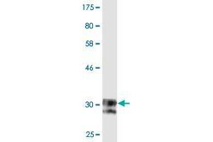Western Blotting (WB) image for anti-Sodium Channel, Voltage-Gated, Type XI, alpha Subunit (SCN11A) (AA 1726-1791) antibody (ABIN524713)