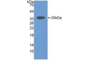 Detection of Recombinant SIRT2, Mouse using Polyclonal Antibody to Sirtuin 2 (SIRT2)