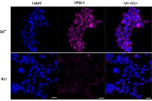 anti-Vacuolar Protein Sorting 41 Homolog (VPS41) antibody