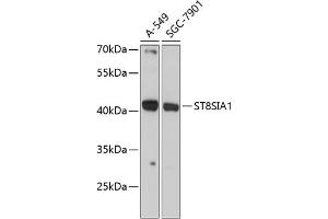 Western blot analysis of extracts of various cell lines, using ST8SI antibody (ABIN6132687, ABIN6148541, ABIN6148542 and ABIN6225056) at 1:3000 dilution. (ST8SIA1 Antikörper  (AA 49-270))