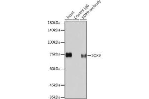 Immunoprecipitation analysis of 200 μg extracts of HeLa cells using 3 μg SOX9 antibody (ABIN7270577). (SOX9 Antikörper)