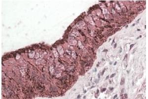 AP20183PU-N ALDH3A1 antibody staining of paraffin embedded Human Lung at 3. (ALDH3A1 Antikörper  (C-Term))