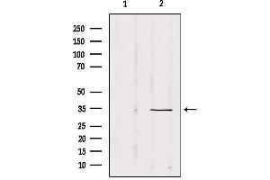 Western blot analysis of extracts from Mouse Myeloma cell, using SOX12 Antibody. (SOX12 Antikörper  (Internal Region))