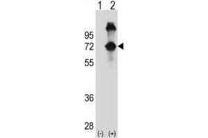 Western Blotting (WB) image for anti-Alveolar Soft Part Sarcoma Chromosome Region, Candidate 1 (ASPSCR1) antibody (ABIN2998788) (ASPSCR1 Antikörper)