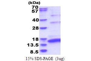 SDS-PAGE (SDS) image for Hepatitis C Virus NS5a (HCV NS5a) (AA 2210-2306) protein (His tag) (ABIN6387451)