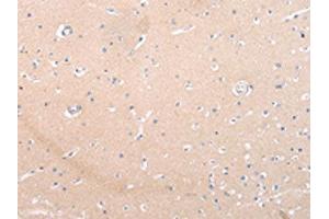 The image on the left is immunohistochemistry of paraffin-embedded Human brain tissue using ABIN7193105(ZNF106 Antibody) at dilution 1/20, on the right is treated with synthetic peptide. (ZNF16 Antikörper)