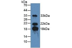 Detection of MBP in Mouse Brain Tissue using Polyclonal Antibody to Myelin Basic Protein (MBP)