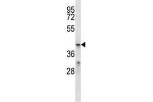 MFSD2B antibody western blot analysis in ZR-75-1 lysate. (MFSD2B Antikörper  (AA 383-411))