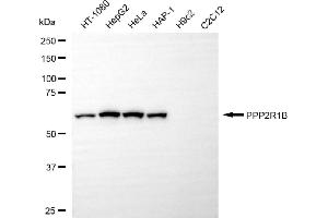 Western blotting analysis using PPP2R1B antibody (ABIN7800022). (PPP2R1B Antikörper)