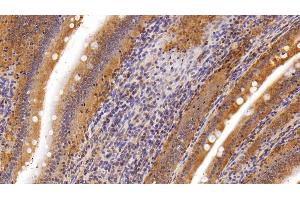 Detection of LPL in Rat Small intestine Tissue using Polyclonal Antibody to Lipoprotein lipase (LPL) (Lipoprotein Lipase Antikörper  (AA 28-474))