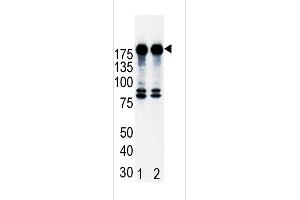Western blot analysis of ErbB2 (arrow) in T47D cell lysates, either noninduced (Lane 1) or induced with HRG (Lane 2). (ErbB2/Her2 Antikörper  (N-Term))