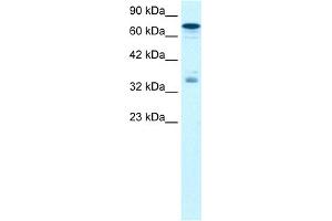 WB Suggested Anti-NFKBIB Antibody Titration:  1. (NFKBIB Antikörper  (N-Term))