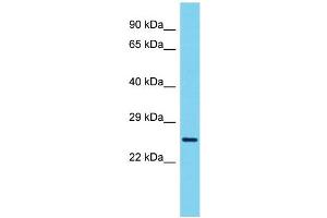Host: Rabbit Target Name: VCX3A Sample Type: ACHN Whole Cell lysates Antibody Dilution: 1. (VCX3A Antikörper  (N-Term))