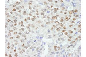 anti-Zinc Finger Protein 295 (ZNF295) (AA 875-925) antibody
