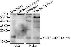 Western blot analysis of extracts of various cells, using Phospho-EIF4EBP1-T37/46 antibody (ABIN5995638). (eIF4EBP1 Antikörper  (pThr36))