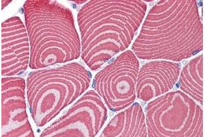 Immunohistochemistry (Formalin-fixed Paraffin-embedded Sections) (IHC (fp)) image for anti-Myosin Heavy Chain 7, Cardiac Muscle, beta (MYH7) (AA 1251-1300) antibody (ABIN6747193)