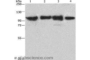 Western blot analysis of Lovo cell and mouse kidney tissue, 231 and hepG2 cell, using ACTN4 Polyclonal Antibody at dilution of 1:485 (alpha Actinin 4 Antikörper)