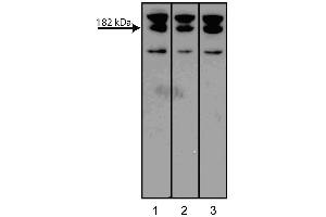 Western blot analysis of AF6 on a PC-12 cell lysate (Rat neuroblastoma, ATCC CRL-1721). (Afadin Antikörper  (AA 1091-1233))