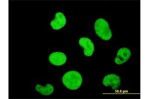 Immunofluorescence of monoclonal antibody to ZNF207 on HeLa cell. (ZNF207 Antikörper  (AA 1-110))