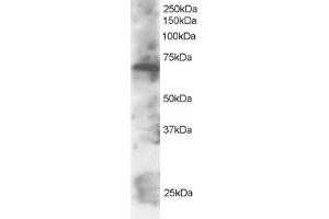 ABIN184723 staining (2µg/ml) of Daudi lysate (RIPA buffer, 30µg total protein per lane). (SWAP70 Antikörper  (C-Term))