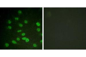 serum + -Immunohistochemistry analysis of paraffin-embedded human brain tissue using DDX3/DEAD-box Protein 3 (Phospho-Thr322) antibody. (DDX3 Antikörper  (pThr322))