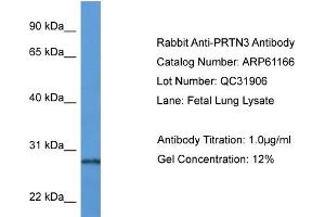 Western Blotting (WB) image for anti-Proteinase 3 (PRTN3) (N-Term) antibody (ABIN2788703) (PRTN3 Antikörper  (N-Term))