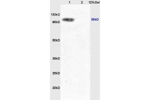 Lane 1: mouse liver lysates Lane 2: mouse lung lysates probed with Anti Phospho-TrkA (Tyr490) /TrkB (Tyr516) Polyclonal Antibody, Unconjugated (ABIN746603) at 1:200 in 4 °C. (TRKA Antikörper  (pTyr496))