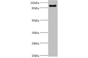 Western blot All lanes: TGS1 antibody at 10 μg/mL + Mouse skeletal muscle tissue Secondary Goat polyclonal to rabbit IgG at 1/10000 dilution Predicted band size: 97 kDa Observed band size: 97 kDa (TGS1 Antikörper  (AA 714-853))