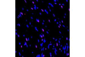 Immunofluorescence of paraffin embedded rat heart using SOCS7 (ABIN7075765) at dilution of 1:650 (300x lens) (SOCS7 Antikörper)