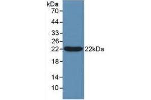 Detection of Recombinant Bcl2L2, Human using Polyclonal Antibody to B-Cell CLL/Lymphoma 2 Like Protein 2 (Bcl2L2) (BCL2L2 Antikörper  (AA 2-193))